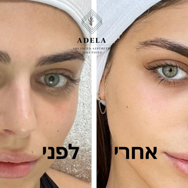 ללא שם (פוסט ל-Instagram (מרובע)) (1200 × 628 פיקסל)